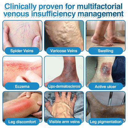 🇨🇦🏆✅️🏃GFOUK® VeinRepair Microneedle Patch Roll⚡Instant Relief, Long-Term Results